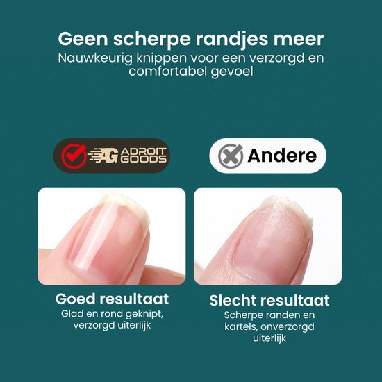 Vergelijking van nette, gladde nagelranden versus scherpe, kartelige nagels voor verzorgde uitstraling