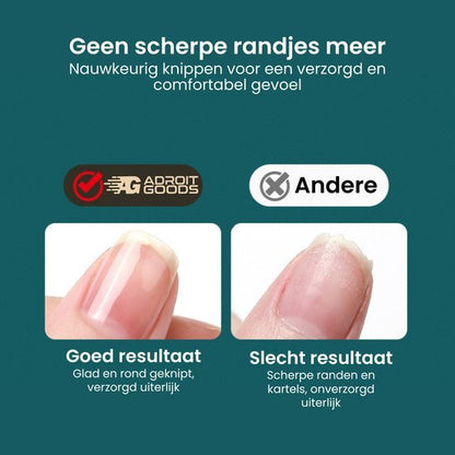 Vergelijking van nette, gladde nagelranden versus scherpe, kartelige nagels voor verzorgde uitstraling