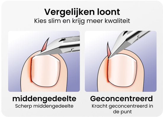 Illustratie van juiste nagelriemverzorging met een scherp en geconcentreerd nagelknippertje