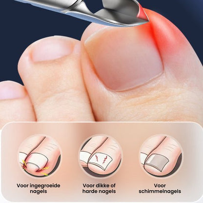 Close-up van teen met rood ontstoken nagel en hulpmiddel bij nagelproblemen zoals ingegroeid en schimmel