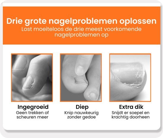 Overzicht van drie nagelproblemen: ingegroeid, diep knippen en extra dikke nagels verzorgen.