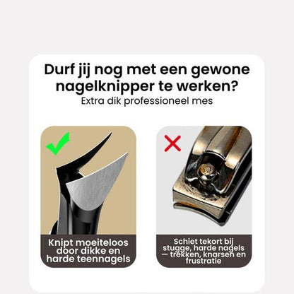 Vergelijking nagelknippers: professioneel mes knipt dikke teennagels moeiteloos, standaard knipt niet goed.