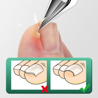 Close-up van een teen met een nagelriemverzorgingstool die dode huid verwijderd bij de nagelrand.