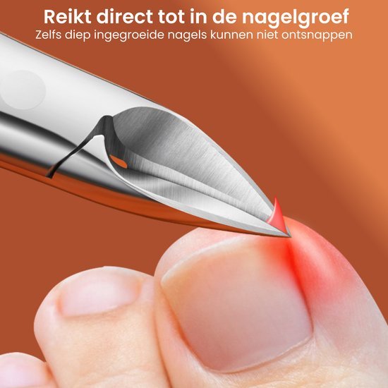 Close-up van een metalen gereedschap dat een ontstoken ingegroeide teennagel behandelt