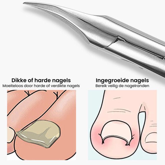 Roestvrijstalen tang voor het veilig knippen van dikke en ingegroeide nagels op voeten.