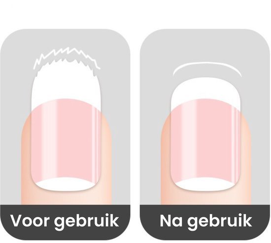 Illustratie van een nagel voor en na behandeling, met beschadigde en gladde nageloppervlakte.