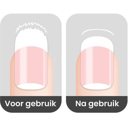 Illustratie van een nagel voor en na behandeling, met beschadigde en gladde nageloppervlakte.