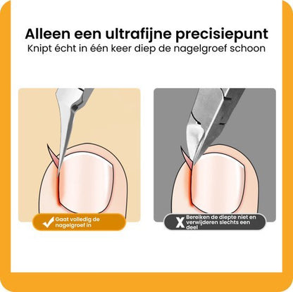Illustratie van een nagelknipper met precisiespunt die diep en volledig de nagelgroef reinigt.